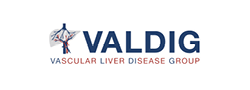 VALDIG